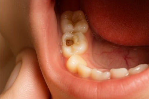 3.jpg__PID:a918ab59-3d00-46fb-80ca-85d7ec353032